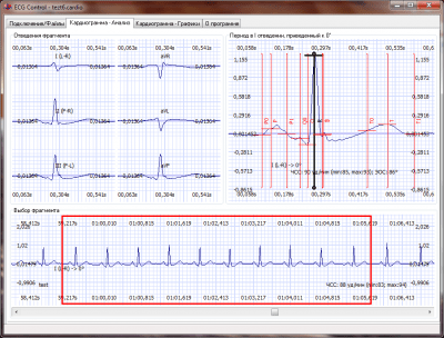 Capture d'écran de l'application ECG Control - #1