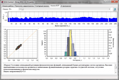 Capture d'écran de l'application ECG Control - #3