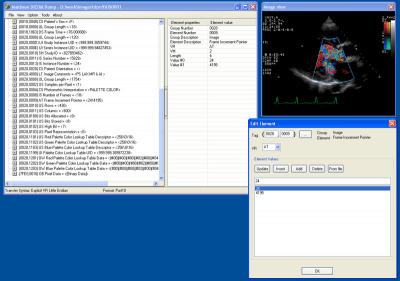 Capture d'écran de l'application Makhaon Dicom Dump - #1