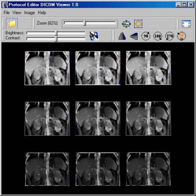 Capture d'écran de l'application DICOM Viewer - #1