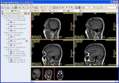 Capture d'écran de l'application Escape Medical Viewer - #1